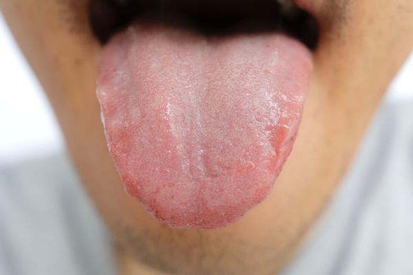 Herpes en la lengua: causas, síntomas y tratamiento - ¿Qué es el herpes y por qué aparece?