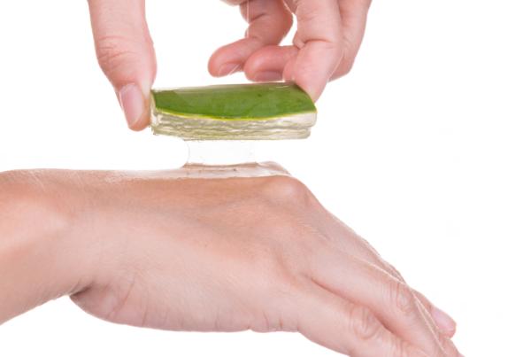 Remedios naturales para combatir la alergia nerviosa de piel - Sábila, grandes beneficios contra la dermatitis nerviosa