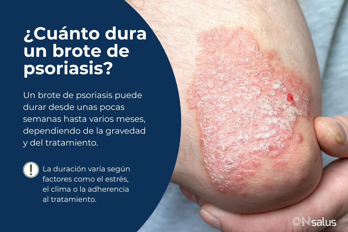 ¿Cuánto dura un brote de psoriasis?