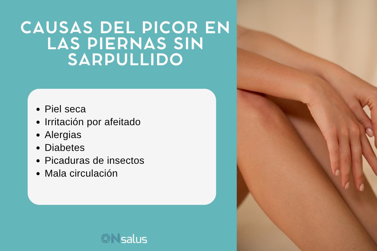Picor en las piernas sin sarpullido: causas