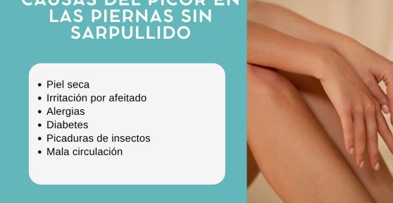 Picor en las piernas sin sarpullido: causas