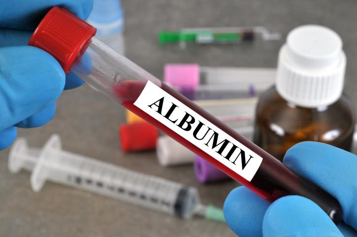 Albúmina Alta En Sangre: Causas y Síntomas