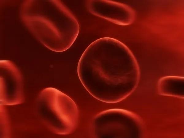 Moretones amarillos sin golpe: ¿por qué salen y cuándo preocuparse? - Trastornos de la sangre