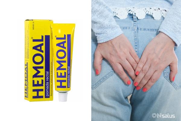 ¿Puedo usar Hemoal si hay sangrado por hemorroides?