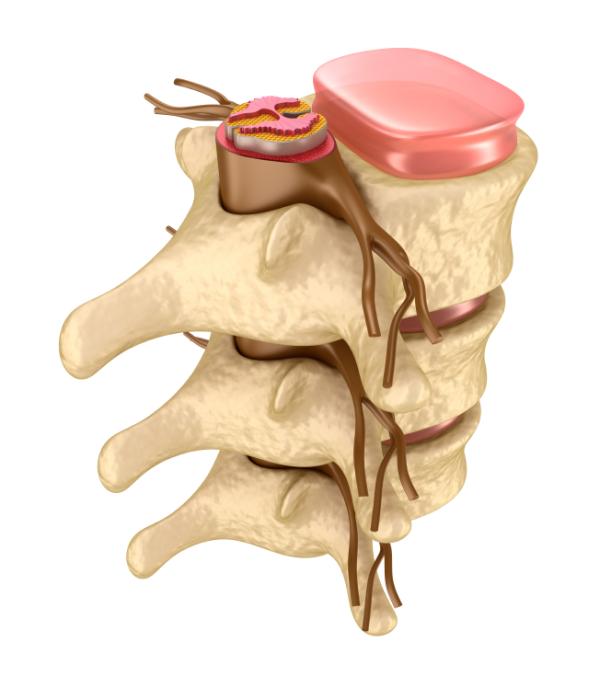 Mielopatía cervical: síntomas, causas y tratamiento