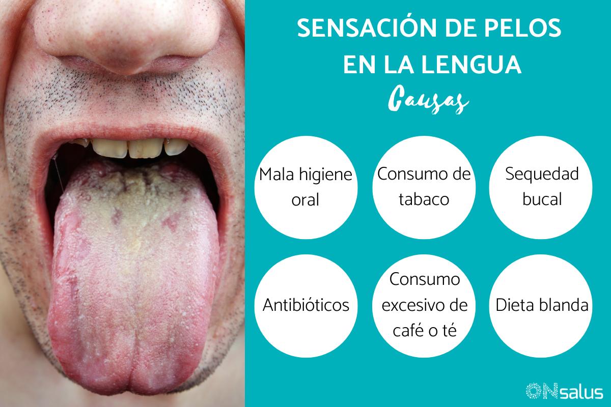 Sensación de pelos en la lengua y garganta - síndrome de lengua vellosa