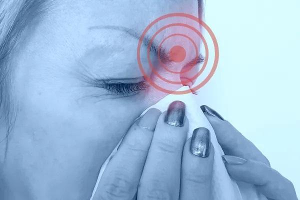 Dolor de cabeza en la parte de arriba: causas y cómo aliviarlo - Sinusitis