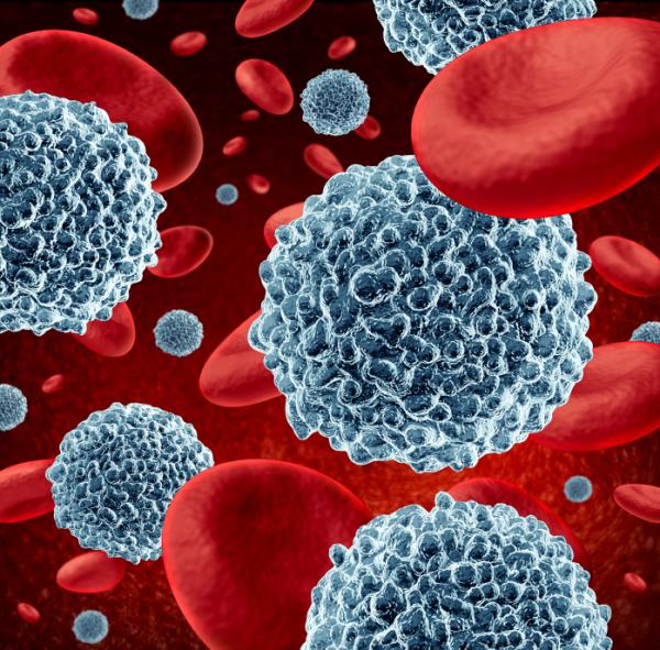 Anemia microcítica: causas, síntomas y tratamiento