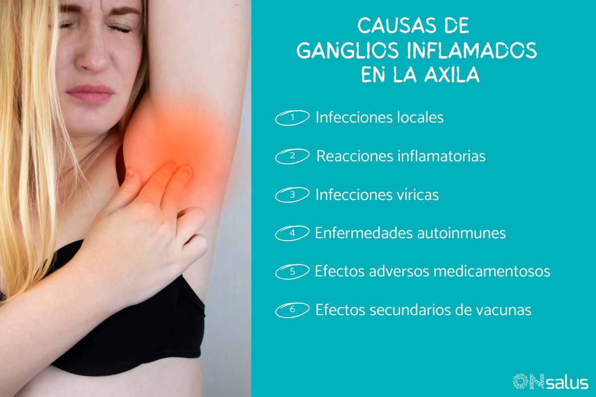 Ganglios inflamados en la axila: causas y tratamiento
