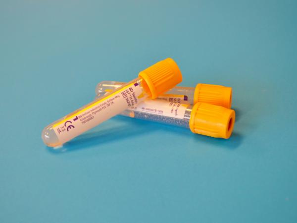 Ferritina baja: síntomas y tratamiento - ¿Cómo se diagnostica?