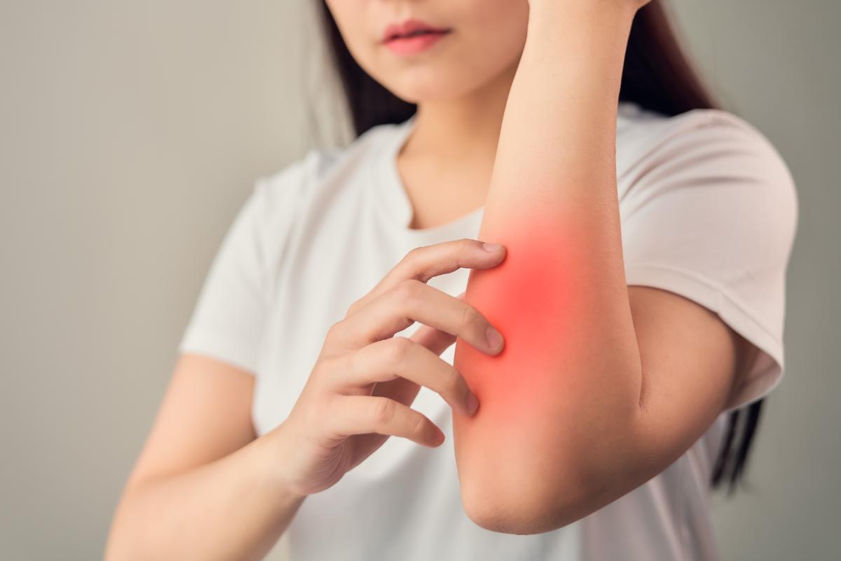 Me duele la piel como si estuviera quemada: causas y tratamiento
