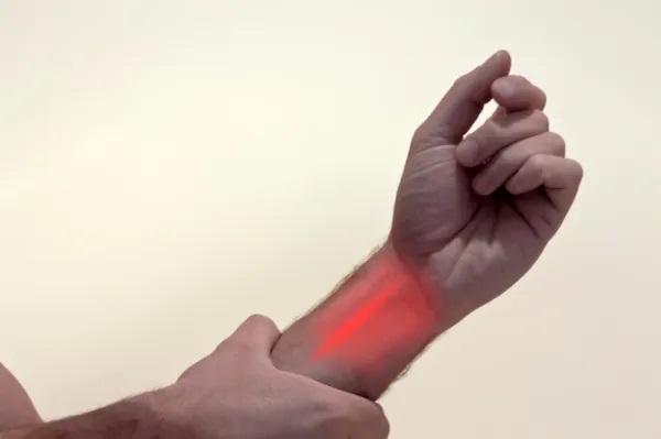 Me duele la piel como si estuviera quemada: causas y tratamiento - Nervio pinzado