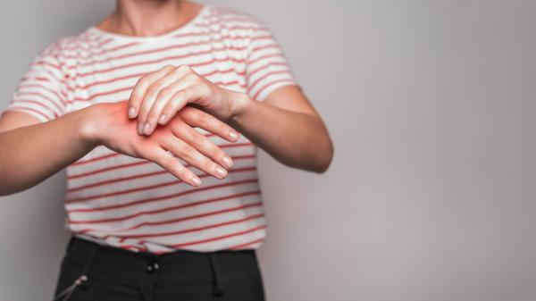 Me duele la piel como si estuviera quemada: causas y tratamiento - Neuropatía periférica