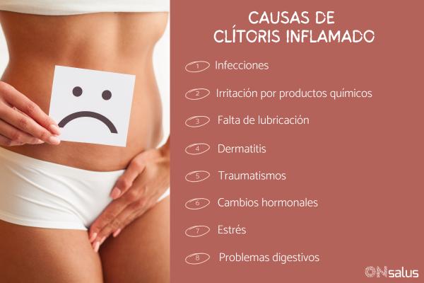 Clítoris inflamado: causas, síntomas y tratamiento