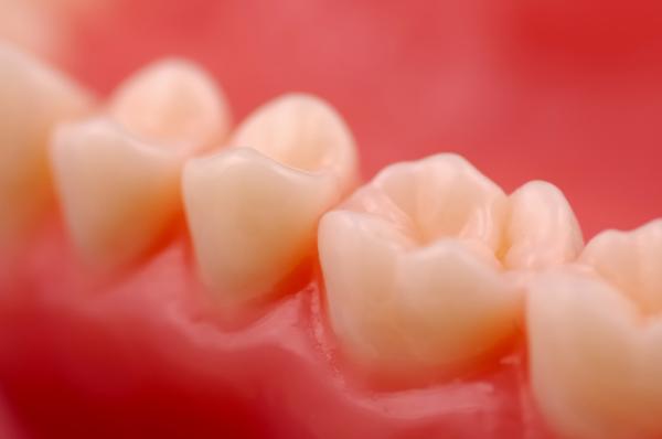 Periodontitis: síntomas, causas y tratamiento - Síntomas de la periodontitis