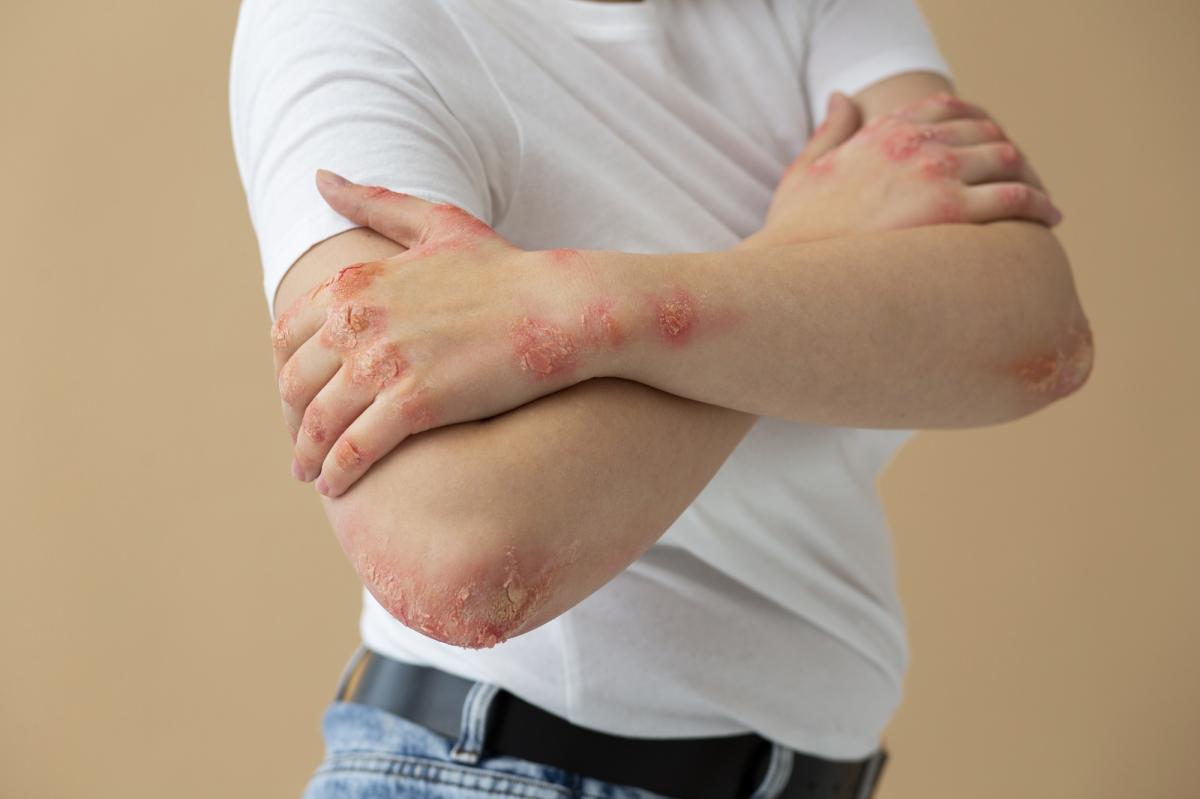 Heridas en la piel que salen solas: causas y tratamiento