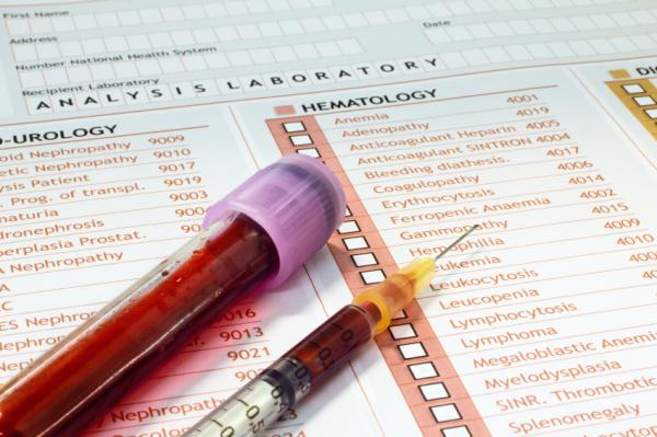 Artritis psoriásica: causas, síntomas y tratamiento - Diagnóstico de la artritis psoriásica