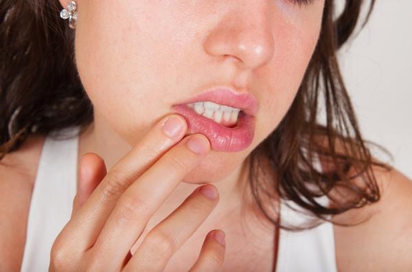 Herpes labial recurrente: causas, síntomas y tratamiento - ¿Por qué sale el herpes labial?
