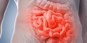 Infarto intestinal: causas, síntomas y tratamiento