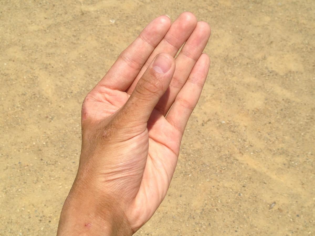 Hormigueo en la mano izquierda: causas
