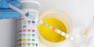 Cuerpos cetónicos en orina sin diabetes: causas, síntomas y tratamiento