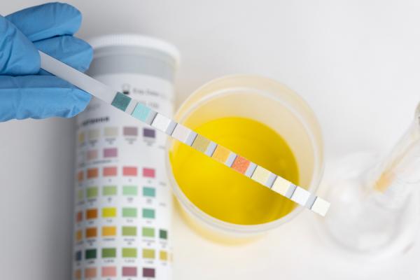Cuerpos cetónicos en orina sin diabetes: causas, síntomas y tratamiento