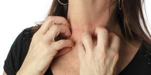 Dermatitis nerviosa: causas, síntomas, tratamiento y remedios caseros
