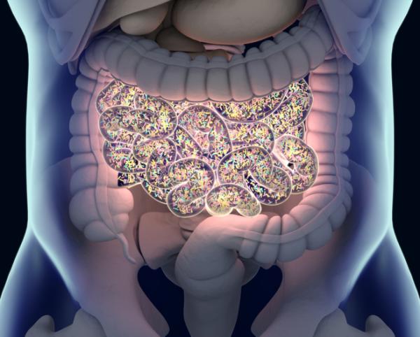 Megacolon tóxico: síntomas, causas y tratamiento - Megacolon tóxico: causas