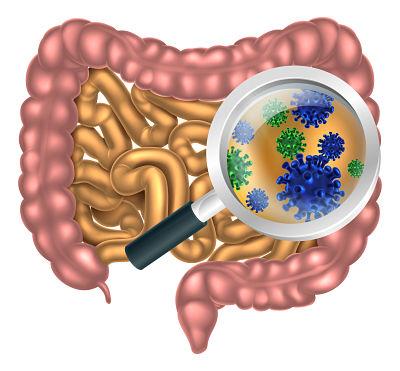 Remedios caseros para la colitis - La importancia de la flora intestinal