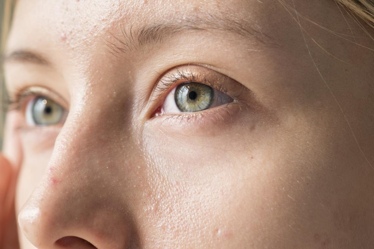 Por qué veo destellos de luz en el rabillo del ojo y qué hacer