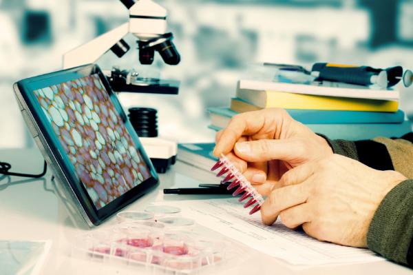 Leucemia mieloide crónica: causas, síntomas y pronóstico - Síntomas de la leucemia mieloide crónica