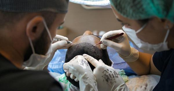 Terapia con exosomas y mesoterapia capilar: combate la alopecia con las técnicas de vanguardia de EVO Beauty Clinics