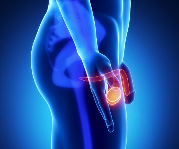 Oligospermia: tipos, causas y tratamientos - Causas de la oligospermia