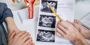 ¿Un teratoma puede volver a salir?