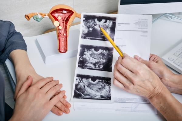 ¿Un teratoma puede volver a salir?