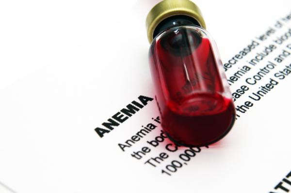 Por qué me canso cuando respiro - Anemia