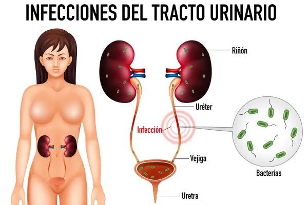 Sensación de infección de orina antes de la regla: causas y tratamiento - Diferencias entre infección urinaria real y sensación similar premenstrual