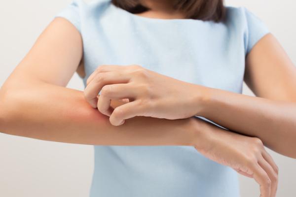 ¿La urticaria es contagiosa? - Urticaria: causas