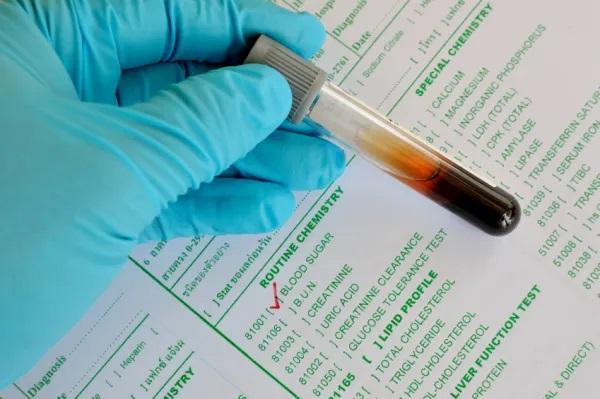 Uñas de los pies moradas sin golpe: causas y tratamiento - Diabetes