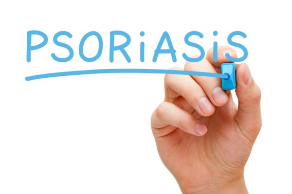 Psoriasis: causas, síntomas y tratamiento