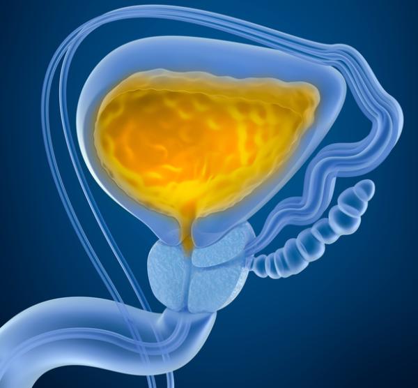 Prostatitis crónica: síntomas y tratamiento - Causas de la prostatitis crónica