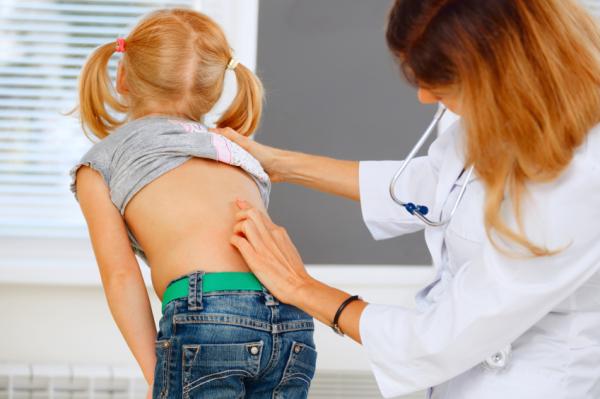 Ejercicios recomendados para la escoliosis - Tratamiento de la escoliosis