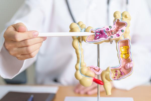 Gases y dolor de ovarios: causas y tratamiento - Síndrome del intestino irritable 