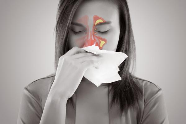 Tengo sinusitis y no se me quita, ¿qué hago? - Síntomas y duración de la sinusitis