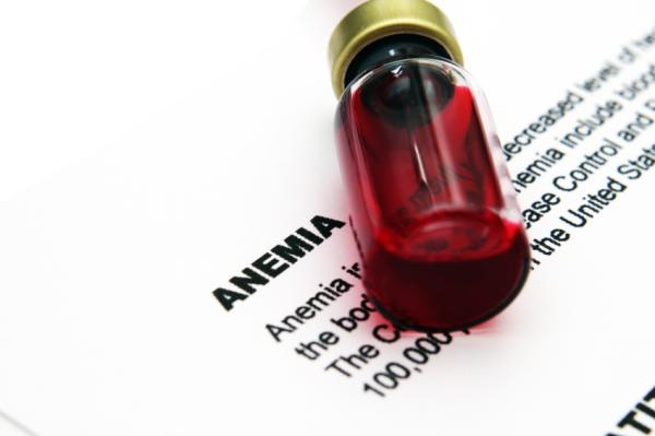 Alimentos para combatir la anemia - La anemia