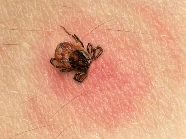 Enfermedad de Lyme: Síntomas y tratamiento - Causas de la enfermedad de Lyme 