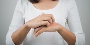 Dermatitis en las manos: causas, tratamiento y remedios caseros