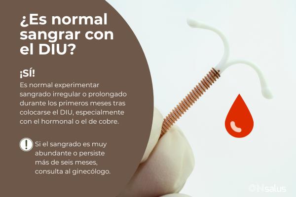  Desde que me puse el DIU no dejo de sangrar: ¿Es normal? 