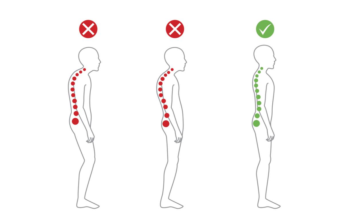 Cifosis dorsal: síntomas, tratamientos y ejercicios correctivos