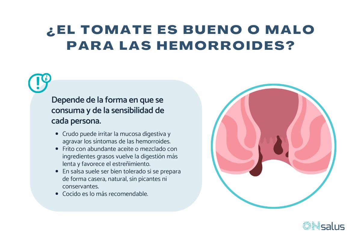 ¿El tomate es malo para las hemorroides?